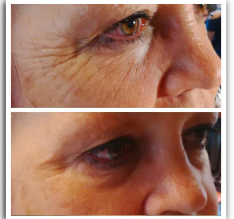 Anti ageless result 3 Anti ageless result